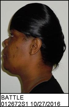 Left Profile
