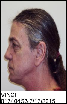 Left Profile