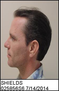 Left Profile