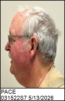 Left Profile