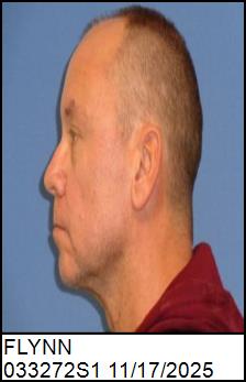 Left Profile