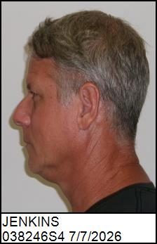 Left Profile