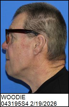 Left Profile