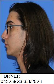Left Profile