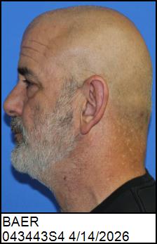 Left Profile