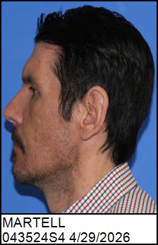 Left Profile