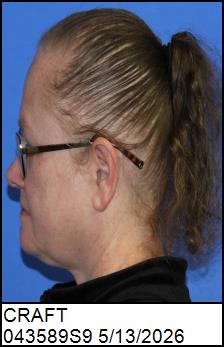 Left Profile