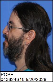 Left Profile