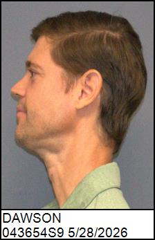 Left Profile