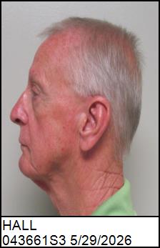 Left Profile