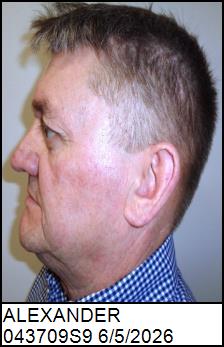 Left Profile