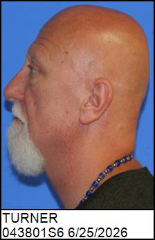 Left Profile