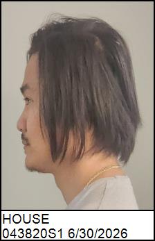 Left Profile
