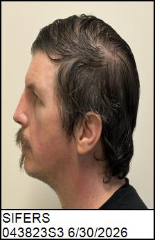 Left Profile