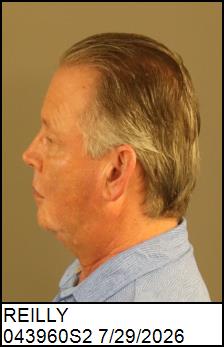 Left Profile