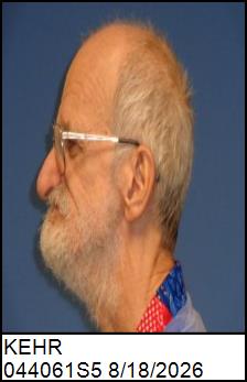 Left Profile