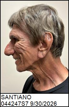 Left Profile