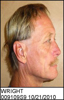 Right Profile