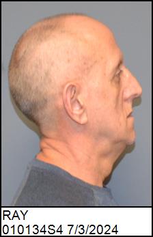 Right Profile