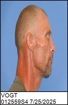 Right Profile