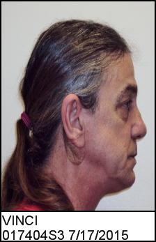 Right Profile