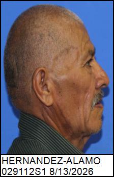 Right Profile