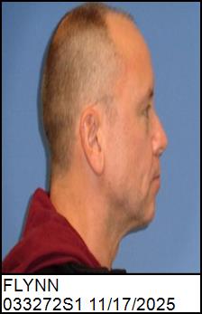 Right Profile