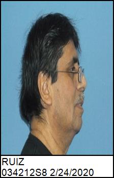 Right Profile
