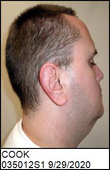 Right Profile
