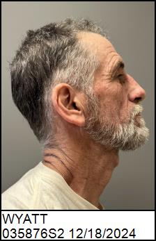 Right Profile