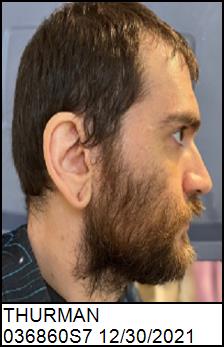 Right Profile