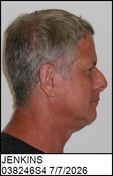 Right Profile