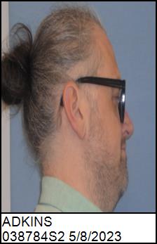 Right Profile
