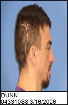 Right Profile