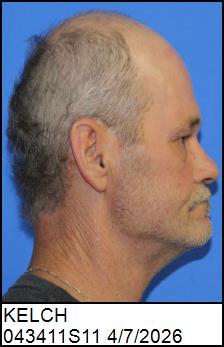 Right Profile