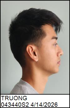 Right Profile
