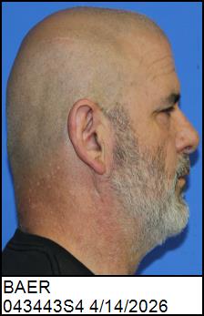 Right Profile