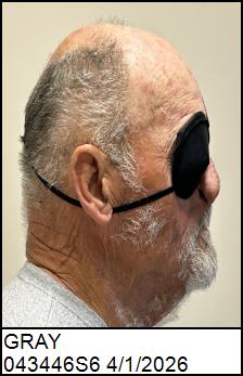 Right Profile