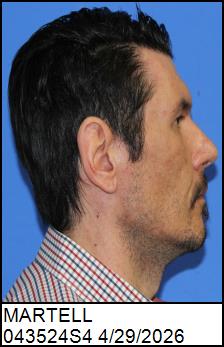 Right Profile