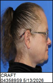 Right Profile
