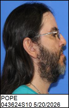 Right Profile