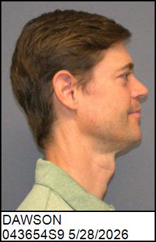 Right Profile