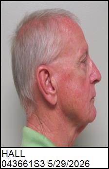 Right Profile