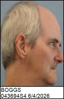 Right Profile