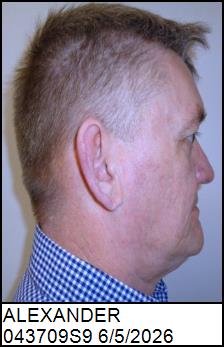 Right Profile