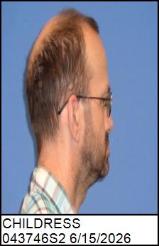 Right Profile