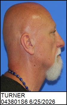 Right Profile