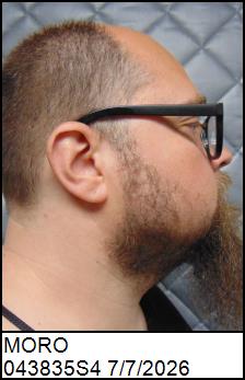 Right Profile