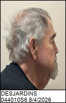 Right Profile