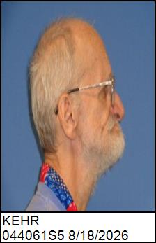 Right Profile